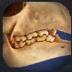 4Molars.PNG 4Molars.PNG