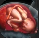 Placenta.PNG Placenta.PNG